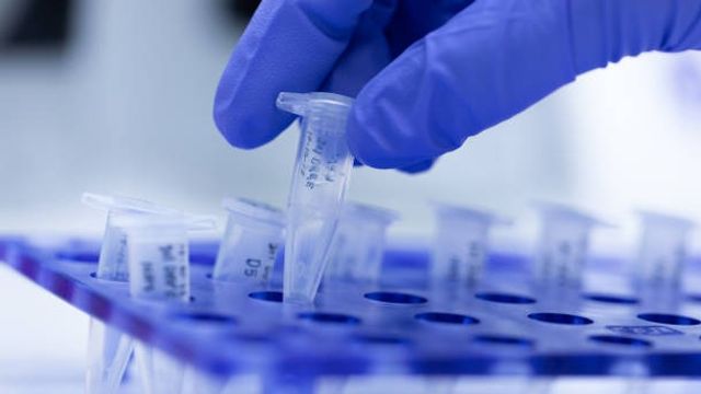 Polymerase Chain Reaction (PCR) and Agarose gel electrophoresis is a method of gel electrophoresis used in biochemistry, molecular biology, genetics, and clinical chemistry in lab