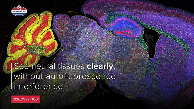 A visual representation of luminous neural tissue