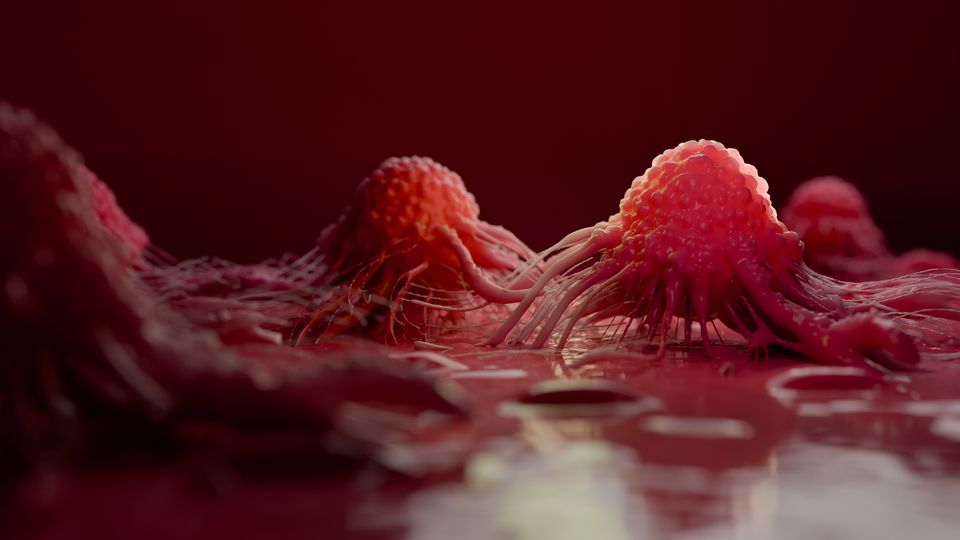 Cancer cells.