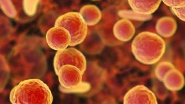 Floating cells. 