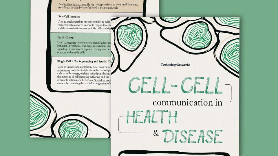 picture of Infographic on a green background