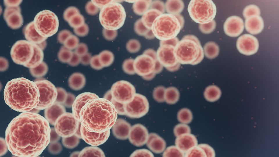 Cancer cells.