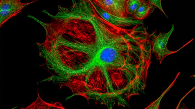Efficient direct translocation of proteins into living cells using BioPORTER® protein delivery reagent.