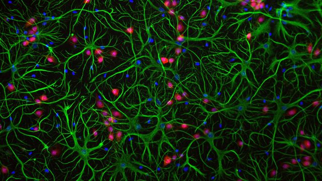 Collection of mammalian cells derived from brain tissue on a black background. Astrocytes have been stained green, nuclei have been stained red (neurons) and blue (all cells).