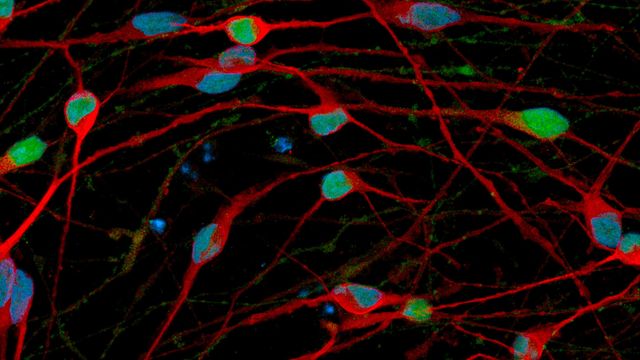 Pure Neurons