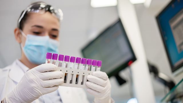 A lab scientist holding test tubes containing blood samples for bioanlysis.