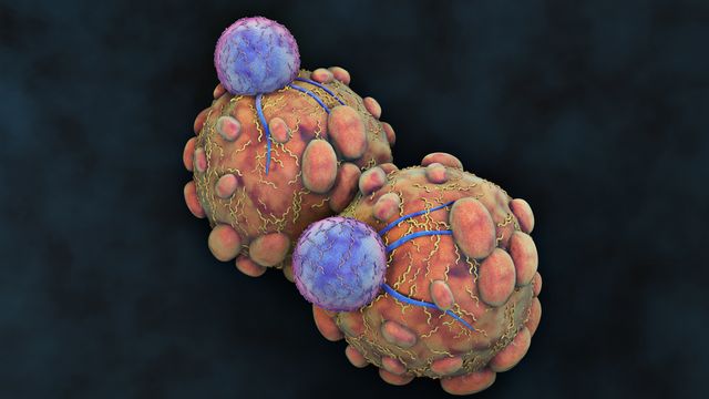 Cancer cells.