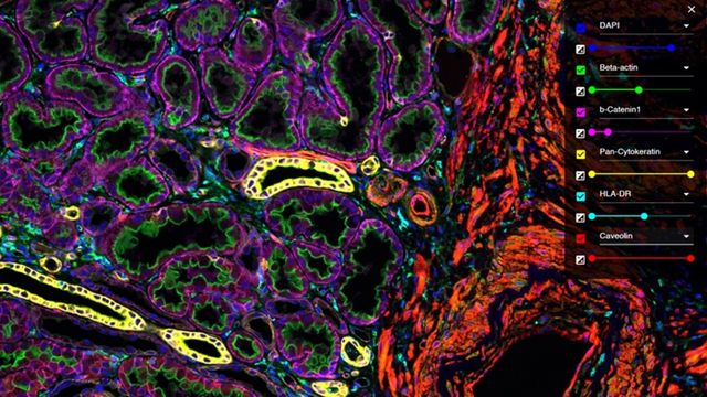 Multiplex single-cell protein profiling of human kidney. Credit: The Human Protein Atlas.